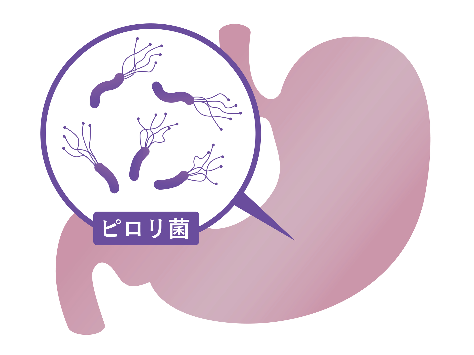 胃の中のピロリ菌のイメージ図